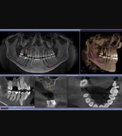 Skaner Dentar